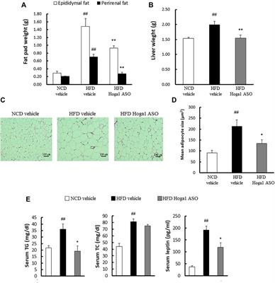 Genetic association-based functional analysis detects HOGA1 as a potential gene involved in fat accumulation